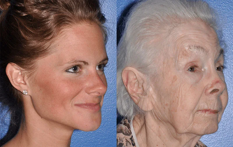 Comparing a younger woman with an older woman's face to show how the aging process affects facial features and skin