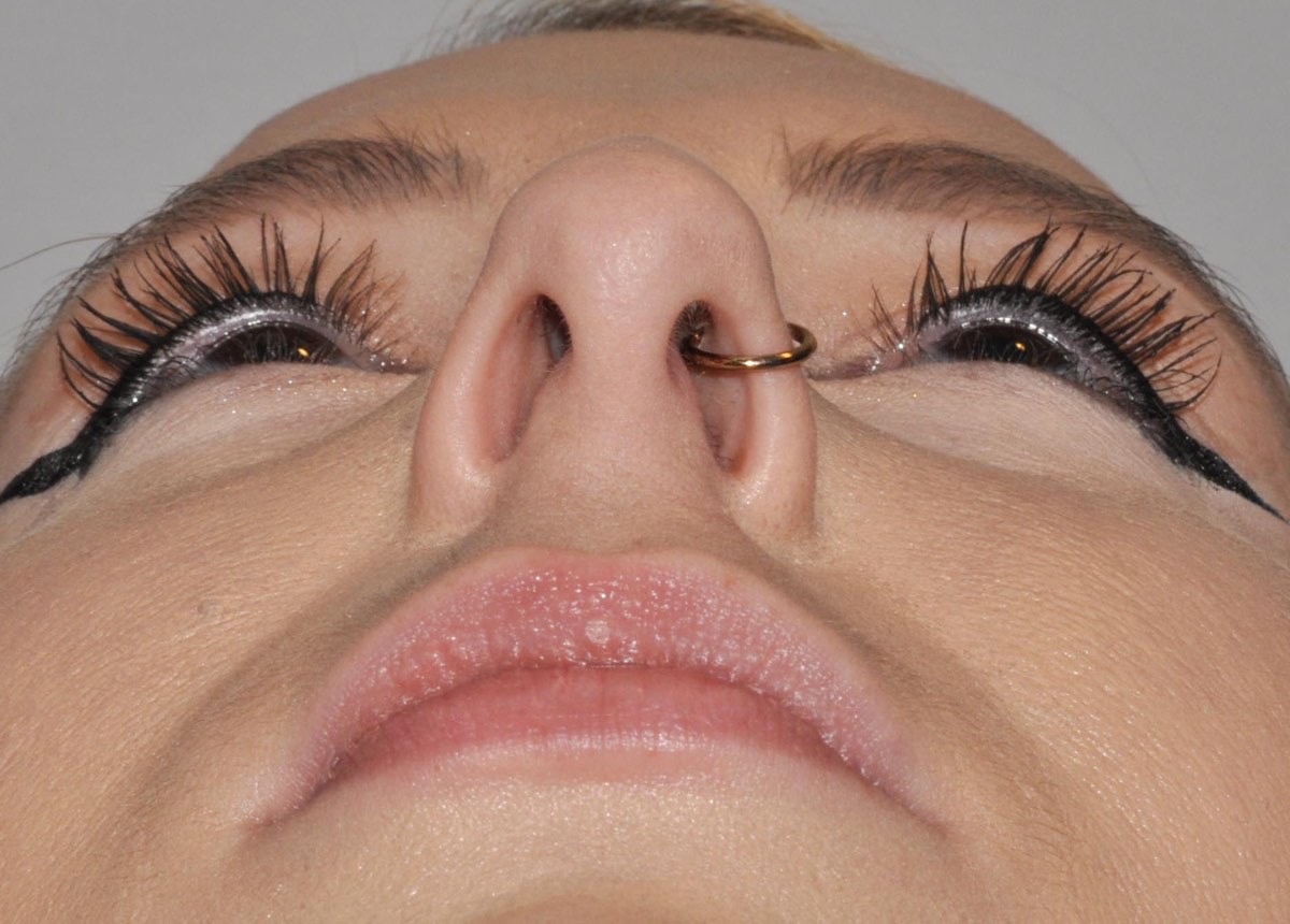 Rhinoplasty