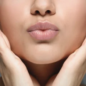 Real patient Lip Lift procedure Seattle