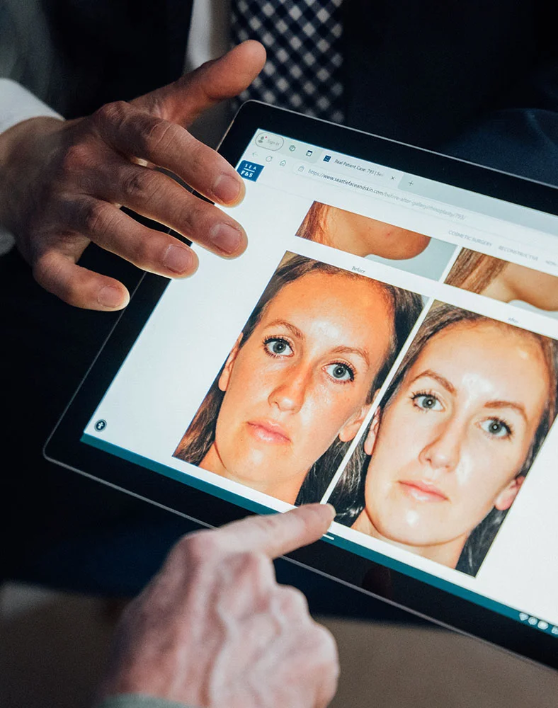 A close up shot of two hands pointing at am ipad showing before and after photos to show clients. - Nasal Reconstruction in Seattle, WA