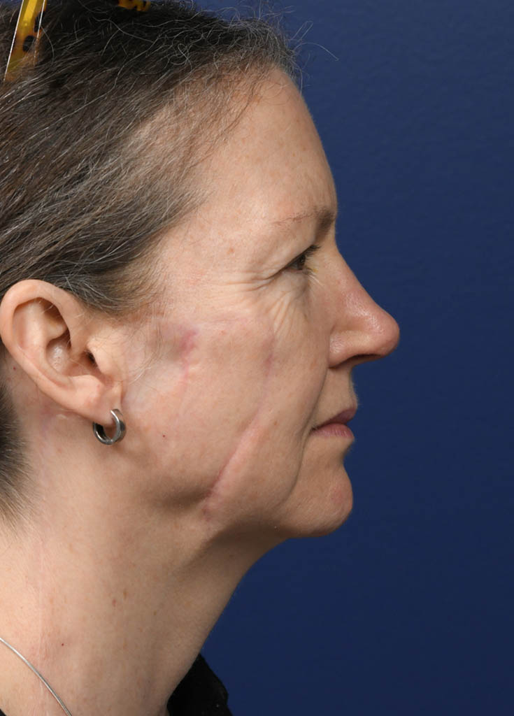 1_0019_SJ Profile 2 Pre Profractional.JPG
